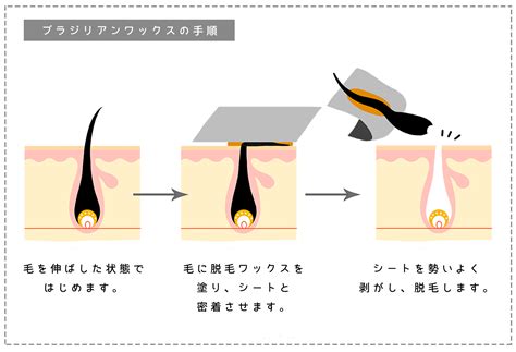 女けつ毛|ブラジリアンワックスのけつ毛脱毛は痛い？適切な処。